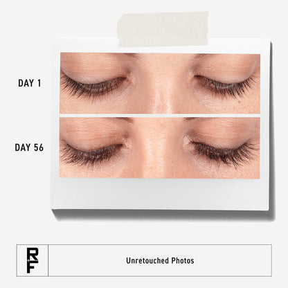 R + F Lash Boost